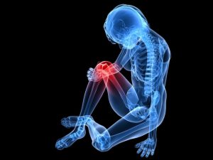 kneepain